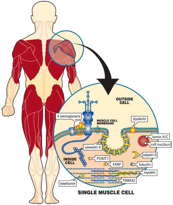 The muscles most affected in LGMD are those surrounding the shoulders and hips, with nearby muscles in the upper legs and arms sometimes also weakening with time. These muscles are shown in red. Inside each muscle cell, many proteins, some of which are shown here in blue and yellow-orange, help the cell contract and protect it from the stress of contractions. When any of the proteins shown here in yellow-orange are missing or nonfunctional, LGMD is the result. At least six of these proteins are normally found in the muscle cell membrane, a sheath surrounding each cell. They form part of the structure of the membrane. Determining which proteins are missing in LGMD and what their normal functions are in the muscle cell are crucial steps in developing treatments.