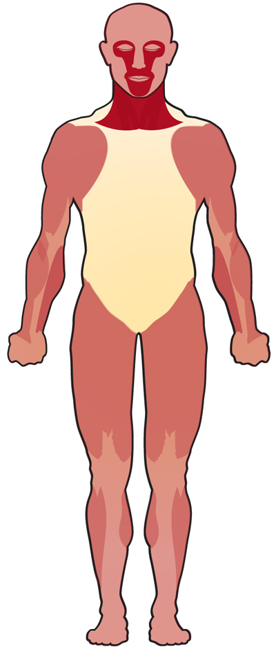 In myasthenia gravis, muscle weakness often first appears in the muscles of the face, neck and jaw. The arm and leg muscles are affected later.