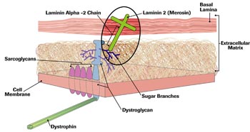 In 1995, researchers identified defects in the laminin alpha-2 chain of laminin 2 (merosin) as a cause of congenital MD. Without its vertical center, the crosslike laminin 2 can't form, and the connection between dystroglycan and the basal lamina is lost.